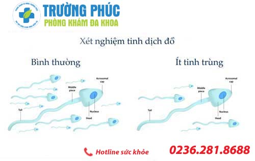 nam gioi phai lam sao khi bi tinh trung it 