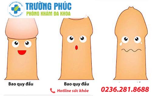 các bệnh thường gặp ở dương vật cac benh thuong gap o duong vat