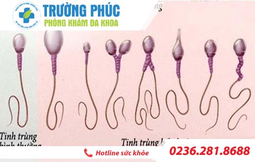 dau hieu nhạn biet tinh trung yeu