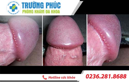chuoi hat ngoc duong vat la gi