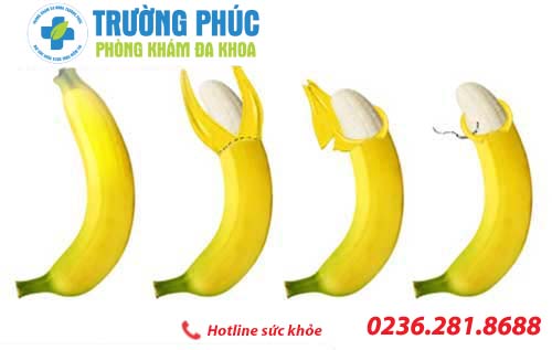 dai bao quy dau co nen cat khong