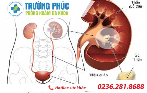 đau tinh hoàn là bệnh gì dau tinh hoan la benh gi