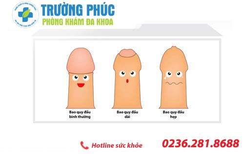 Địa chỉ hỗ trợ điều trị hẹp bao quy đầu