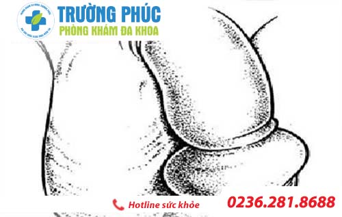 duong vat bi sung va phuong phap ho tro dieu tri hien nay