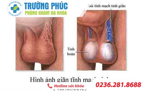 nguyen nhan gay tinh trung it o nam gioi