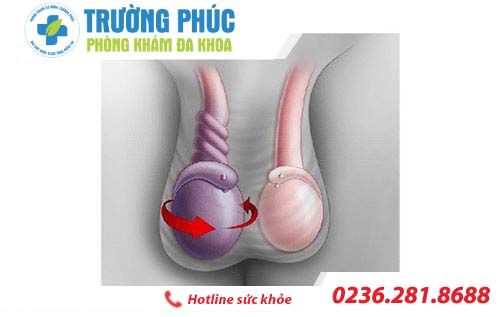 nhung benh lien quan den tinh hoan