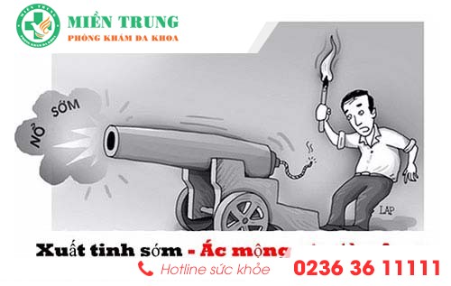 nhung dieu can biet ve benh xuat tinh som