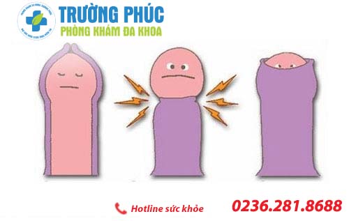 phuong phap cat bao quy dau hieu qua