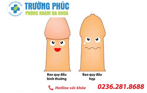 Phương pháp hỗ trợ điều trị hẹp bao quy đầu
