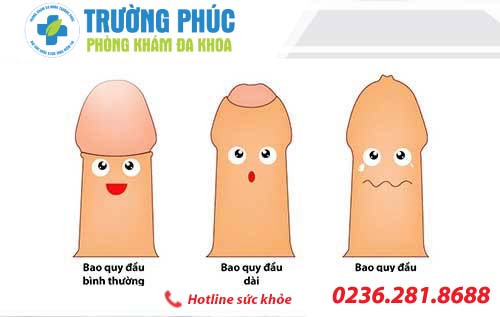phương pháp hỗ trợ điều trị dài bao quy đầu hiệu quả