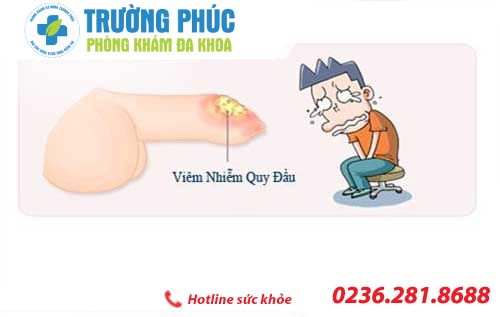 Tác hại của viêm bao quy đầu nên biết