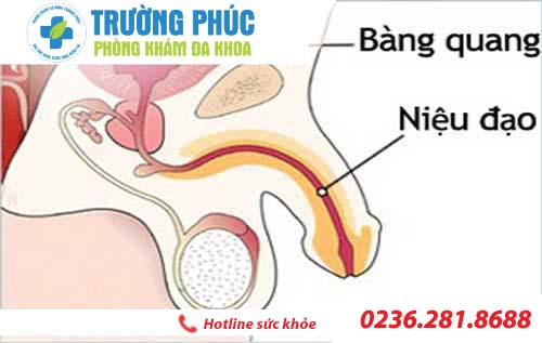 Tìm hiểu bệnh viêm niệu đạo ở nam giới