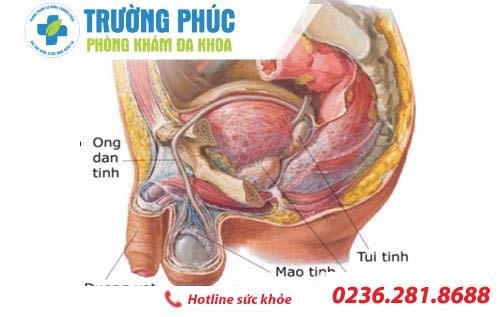 kiến thức về bệnh viêm mào tinh hoàn kien thuc ve benh viem mao tinh hoan
