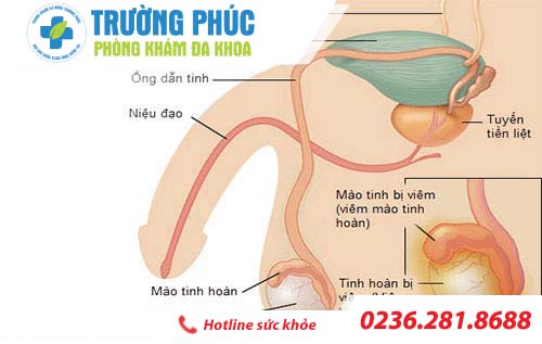 kien thuc ve benh viem tinh hoan o nam gioi