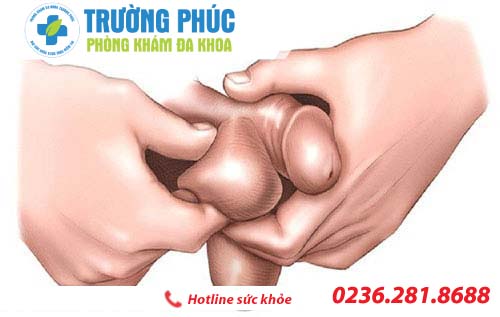tinh hoan to co sao khong